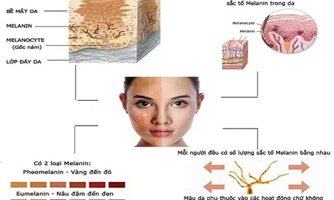 Thực sự tồn tại cách trị tàn nhang dứt điểm ngay tại nhà?